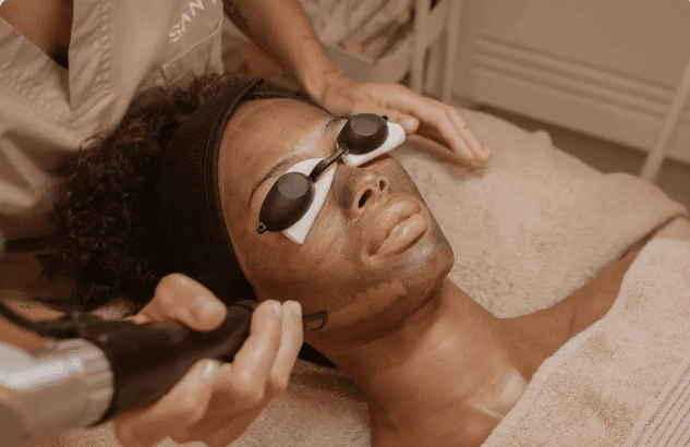 Laser Hollywood Peeling