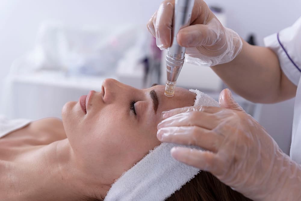 PRP Vampire Facial